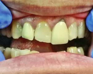 cosmetic dentistry