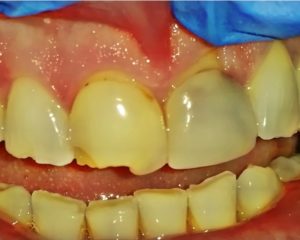 cosmetic dentistry