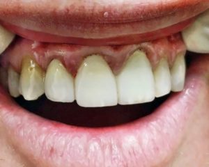 emergency dentist