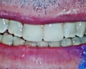 emergency dentist