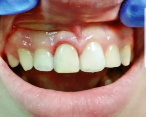 family dentistry